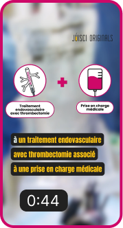 Endovascular therapy for acute stroke with large infarction.